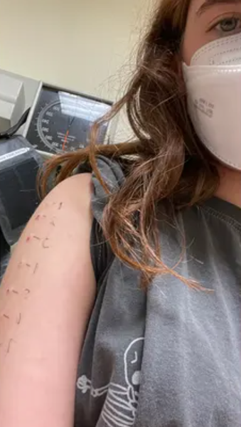 Аллергия на еду, какие продукты можно есть, а какие нет, как живет девушка, у которой врачи обнаружили более 100 различных аллергий