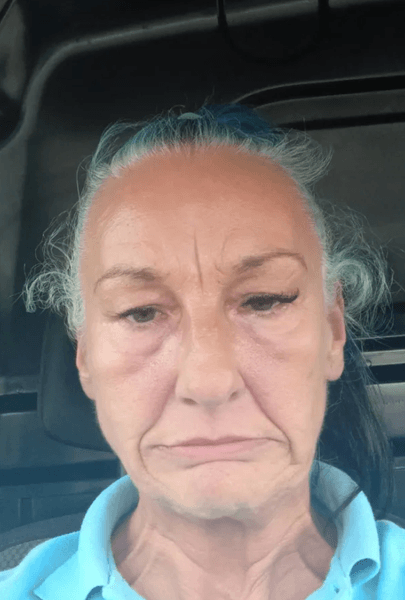 Мойра Девлін після процедури