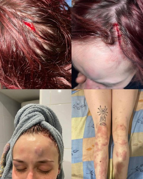 ТЦК, Антонина Токмакова, Токмакова, избил костылями, избил работник ТЦК