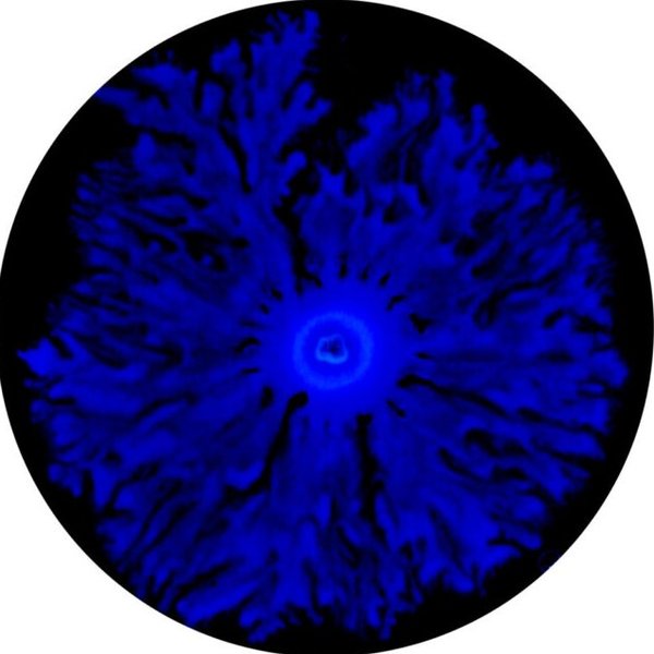 бектерії кишкова паличка