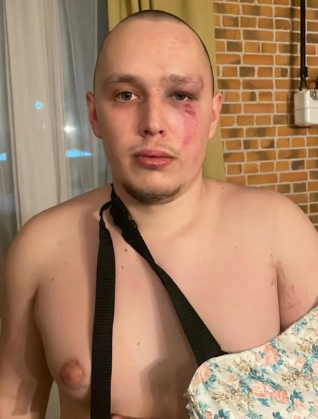 Ветеран ВСУ, Алексей Иванин, избиение ветерана, избиение ветерана