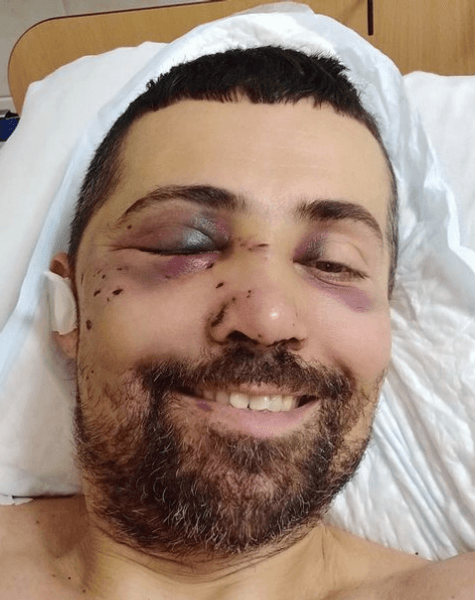 Дмитрий Линартович, ранен Дмитрий Линартович, актер Дмитрий Линартович, Дмитрий Линартович в больнице