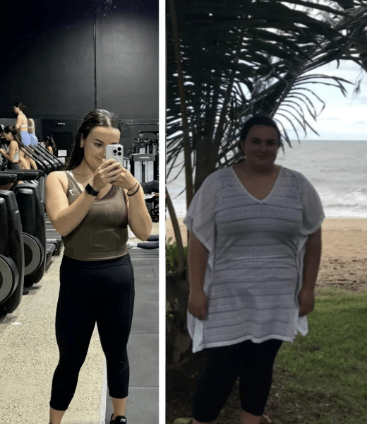 Наднормено тегло, загуба на тегло, отслабване Наднормено тегло, загуба на тегло, отслабване, момиче, медицинска сестра, ходеше много, 10 хиляди стъпки на ден, просто упражнение, диета