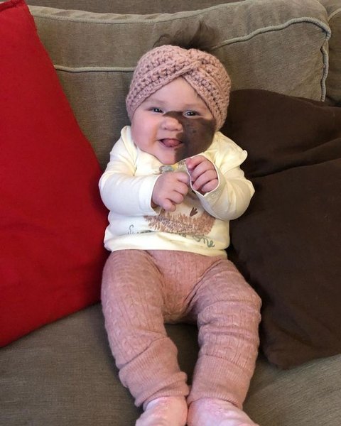 Харпер Кинг, родинка, патология