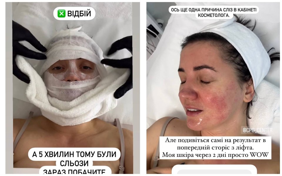 Співачка вийшла після процедури в сльозах