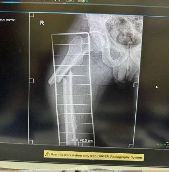 Мобилизация в Украине, всеобщая мобилизация, новости мобилизации, мобилизация новости, мобилизация в Днепре, Днепр, ТЦК Днепр, ТЦК, военкомат, конфликт с ТЦК, избили ТЦК, избили, избиение, избиение, избиение в Днепре, Ростислав Билаенко