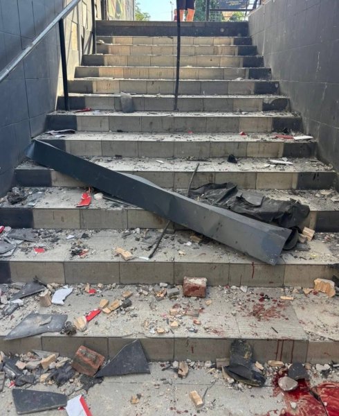 Унаслідок удару 13-річна дівчина отримала важкі поранення