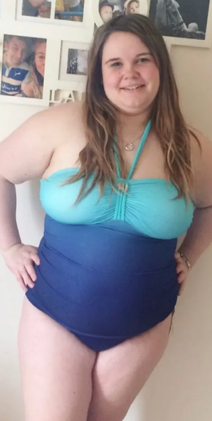 Как похудеть к лету, диеты, операция на желудке, рацион, питание, похудение до и после, фото, Великобритания