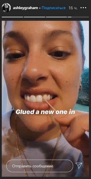 Эшли Грэм вставила новый зуб