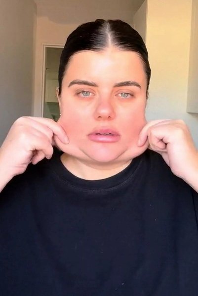 Схуднення, друге підборіддя, ліпосакція, краса, зовнішність, пластична операція, Анжела Хатчінсон з Великої Британії, фото