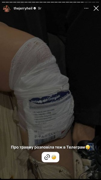 Jerry Heil травмировала колено на полуфинале Евровидения 2024