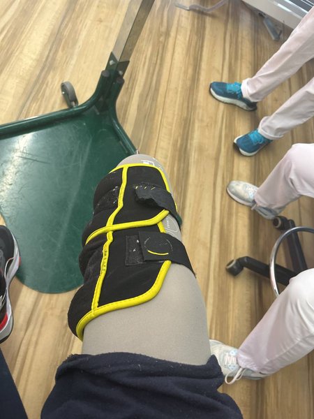 ранение на войне, ампутация на войне, адаптация раненых, раненые бойцы всу, реабилитация бойцов, реабилитация раненых, безбарьерное пространство, доступность для инвалидов, люди с ампутациями, безбарьерность, доступность городов