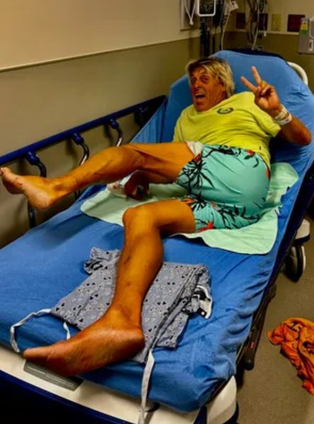 Пригоди серфінгіста, Чарлі Хаєк, укус акули