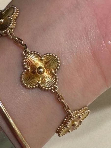 Жінка обурилася, коли її браслет від елітного бренду вже за два місяці почав змінювати колір, всі подробиці скандалу