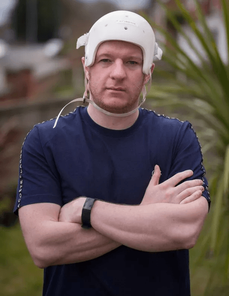 Операция по восстановлению черепа, удалили часть черепа, часть черепа из пластика, новаторская операция, получил сильный удар