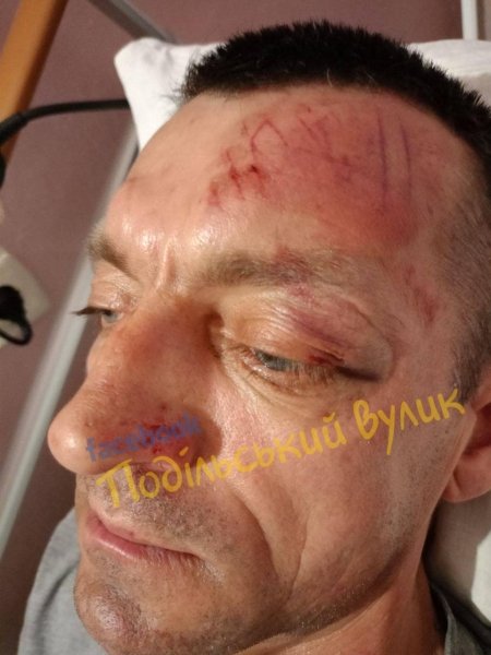 військовий побиття1 139f40a9 06e524b8ac763617ffd2093323168dec Економічні новини - головні новини України та світу