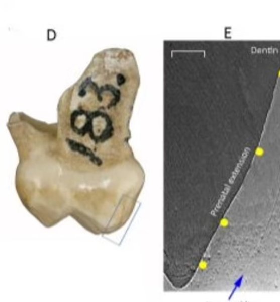 зуб, ребенок, неандерталец