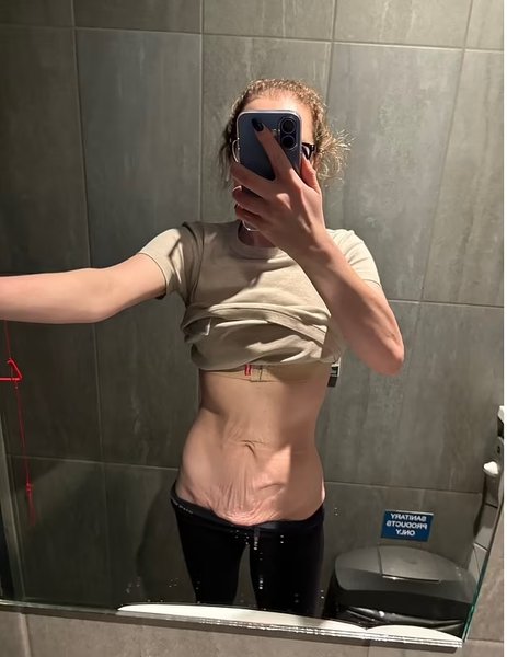 потеря веса, похудение