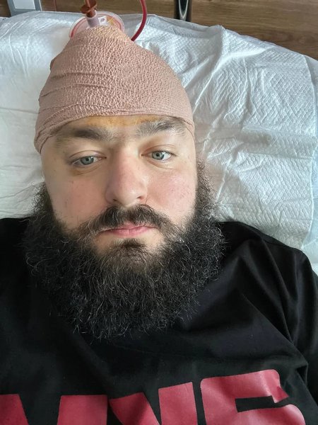 Крововилив у мозок Вені