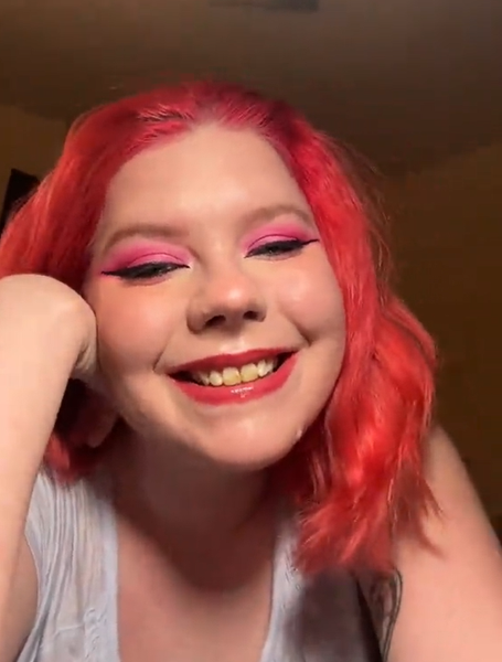 Как выровнять кривые зубы, женщина показала результат ухода за зубами, улыбка до и после посещения стоматолога