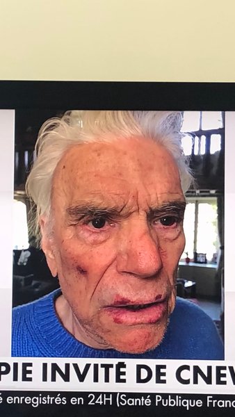 бернар тапи, доминик тапи