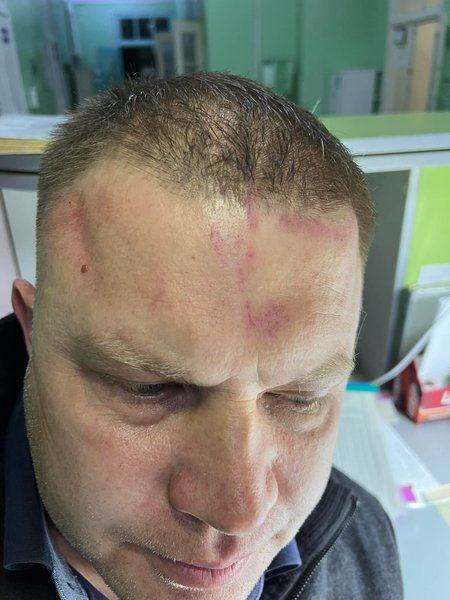 Мэр Белгород-Днестровского Виталий Граждан