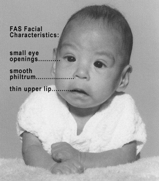 ребенок лицо алкоголь