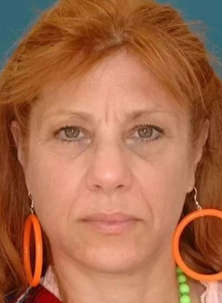 Однояйцевые близняшки, как изменилась их внешность, учитывая различные перипетии судьбы, интересный эксперимент