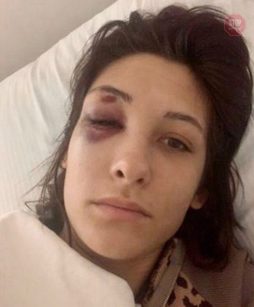 наталья ночвай