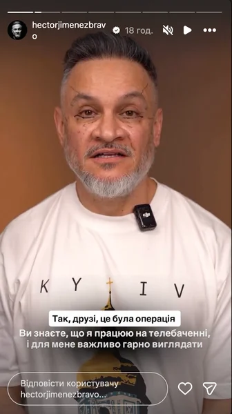 Ектор Хіменес-Браво решился на операцию