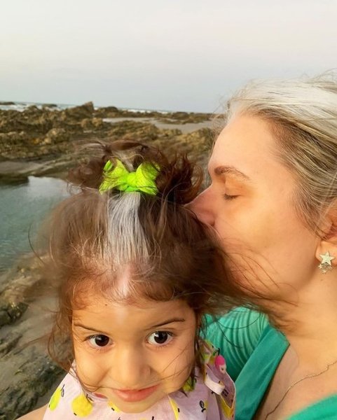 девочка, волосы, альбинизм