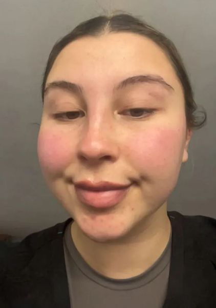 Женщина решила увеличить губы в салоне красоты, но процедура пошла не по плану, курьезы, внешность