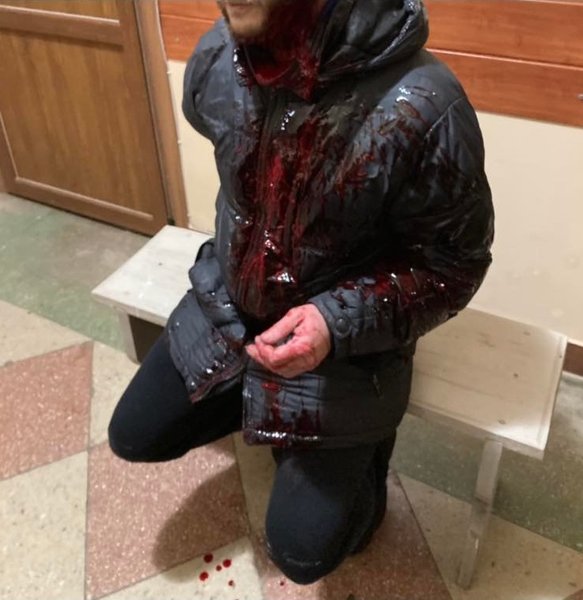 Львовская область, Сокаль, ножевые ранения в Сокале, отказ в оказании медпомощи