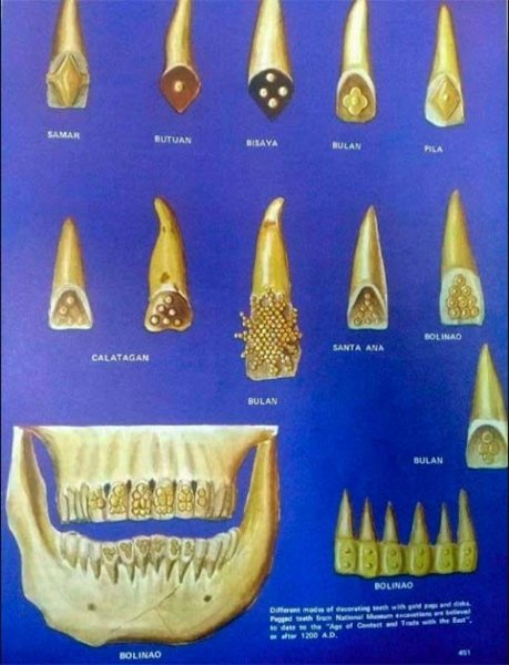 череп, золото, зуб, украшения, орнамент, практика, христианство, древние люди