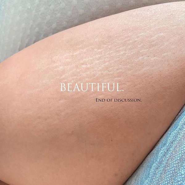 Эшли Грэм, фигура, недостатки