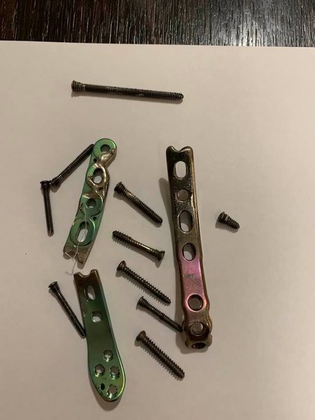 Дмитрий Ярош, ярош операция, ярош война на донбассе, правый сектор, правый сектор ярош