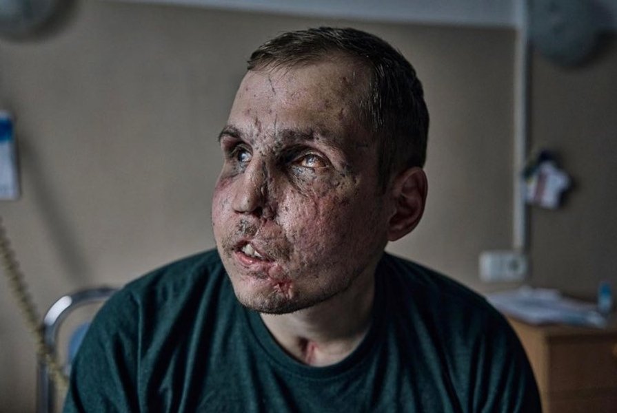 26-летний украинский военнослужащий Сергей Райлян