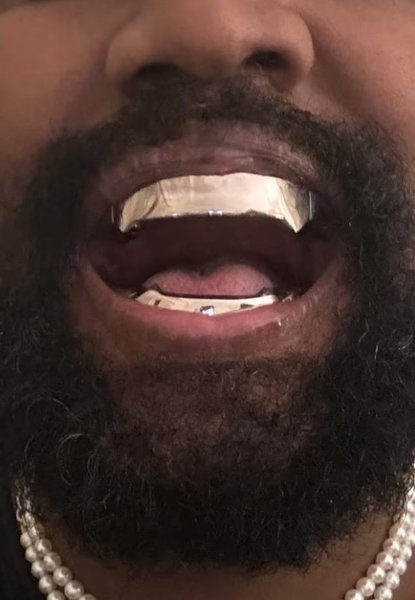 каньє Вест титан зуби