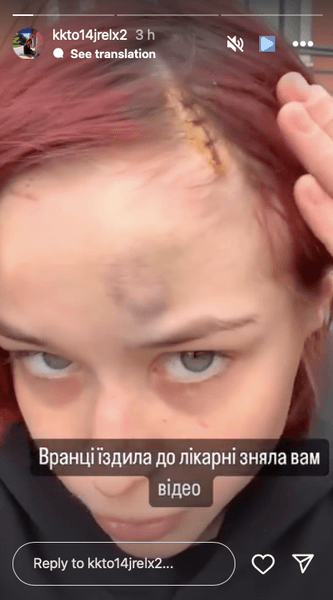 Пострадавшая одесситка, одесситка тцк костыль