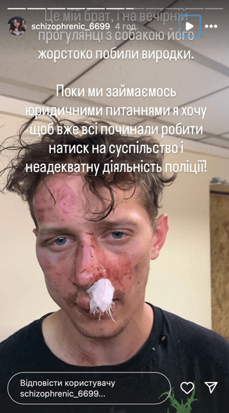 Изображение избитого бывшего военного