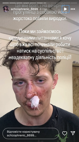 Побитий колишній військовий Зображення побитого колишнього військового