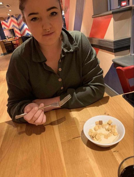 Жінка 20 років їсть тільки картоплю, рідкісна хвороба, рідкісна фобія, дівчина боїться їжі, ARFID, 20 років їла картоплю