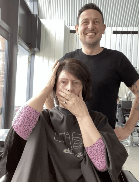 Женщина, волосы, пересадка волос, прическа, выпадение волос,