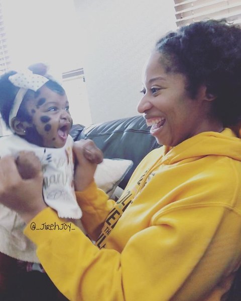 девочка с пятнами на лице, невус