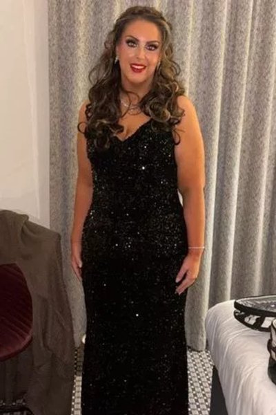 Женщина похудела на 70 кг, лишний вес, операция, бандажирование желудка, резкое похудение, фото до и после, диета,