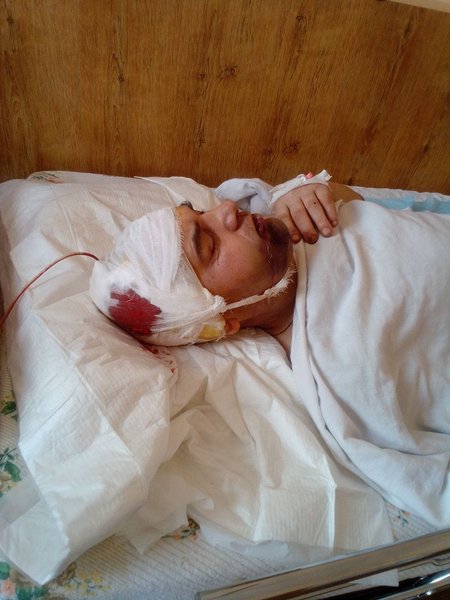 избиение солдата, всу, гбр, расследование избиения, прокуратура, избили раненого солдата, избили солдата на волыни