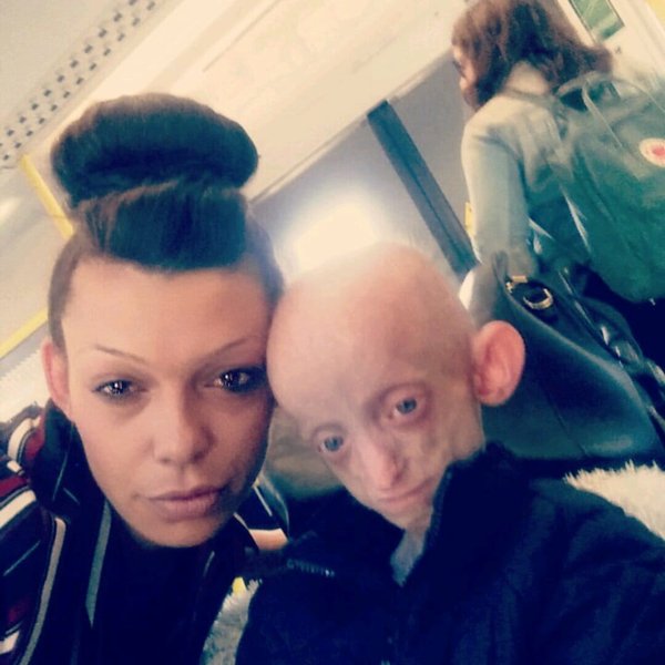 Ашанти Смит, дочь, прогерия