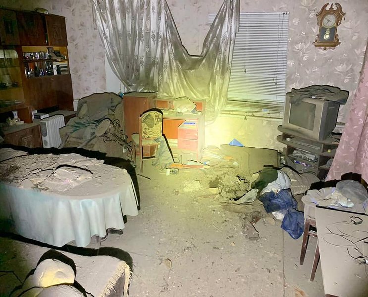 6-річна дівчинка втратила обидві ноги через обстріл Нікополя