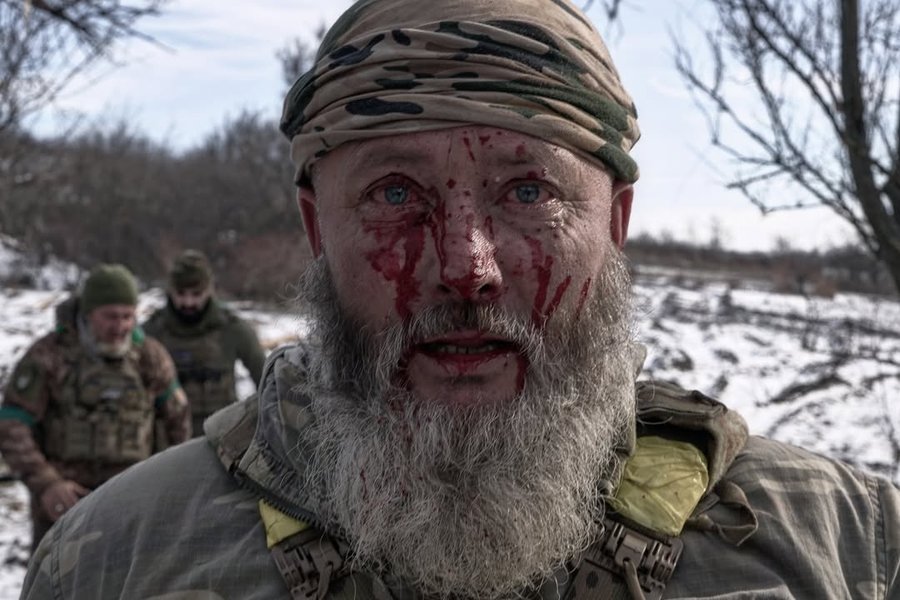 Поранений український військовий