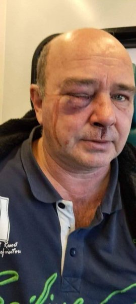 У Київській області працівники ТЦК жорстоко побили чоловіка на очах у поліції